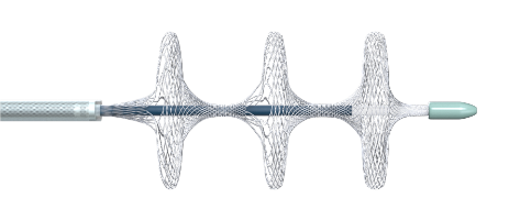 國內首創！本市研發生產的1款Ⅲ類創新醫療器械獲批上市，為具有溶栓禁忌癥的患者提供了治療選擇